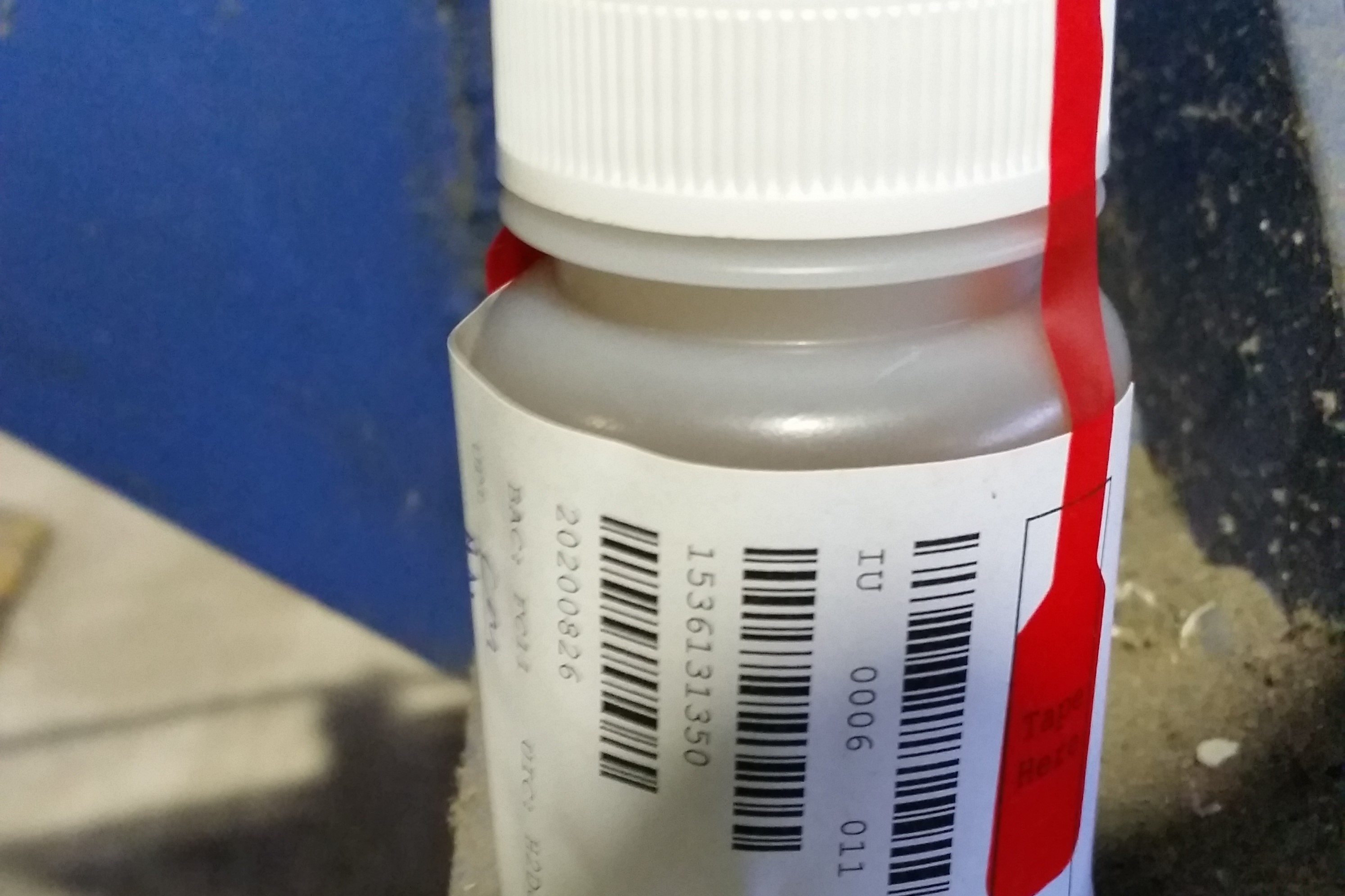 CONTAMINATION: URINE SAMPLE
