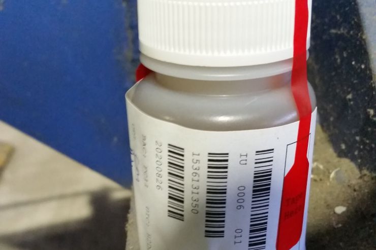 CONTAMINATION: URINE SAMPLE
